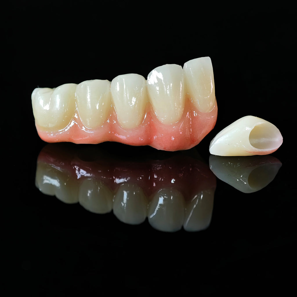 High - Strength Zirconia Crown And Bridge