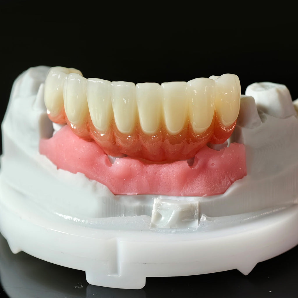 High - Strength Zirconia Crowns And Bridge