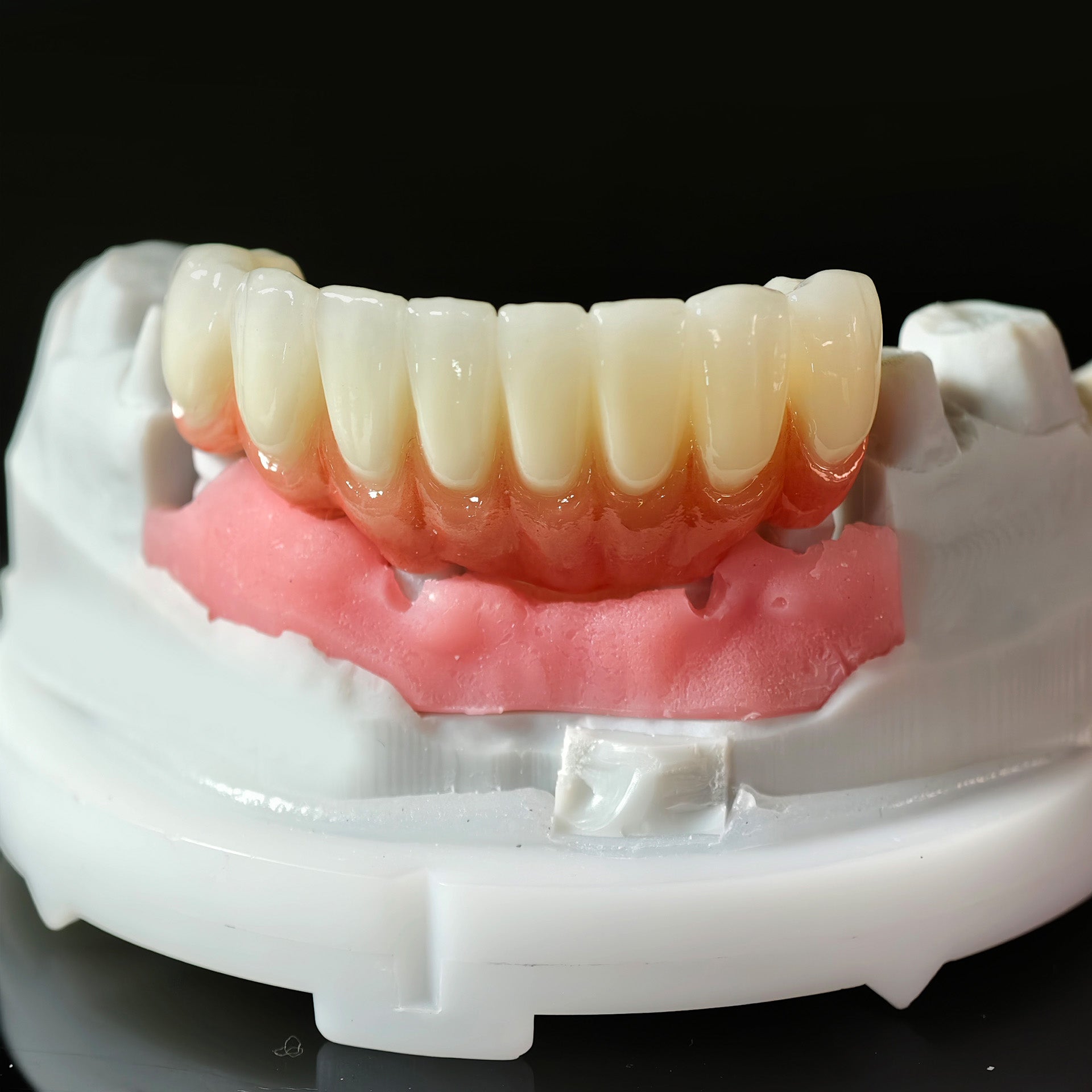 High - Strength Zirconia Crowns And Bridge