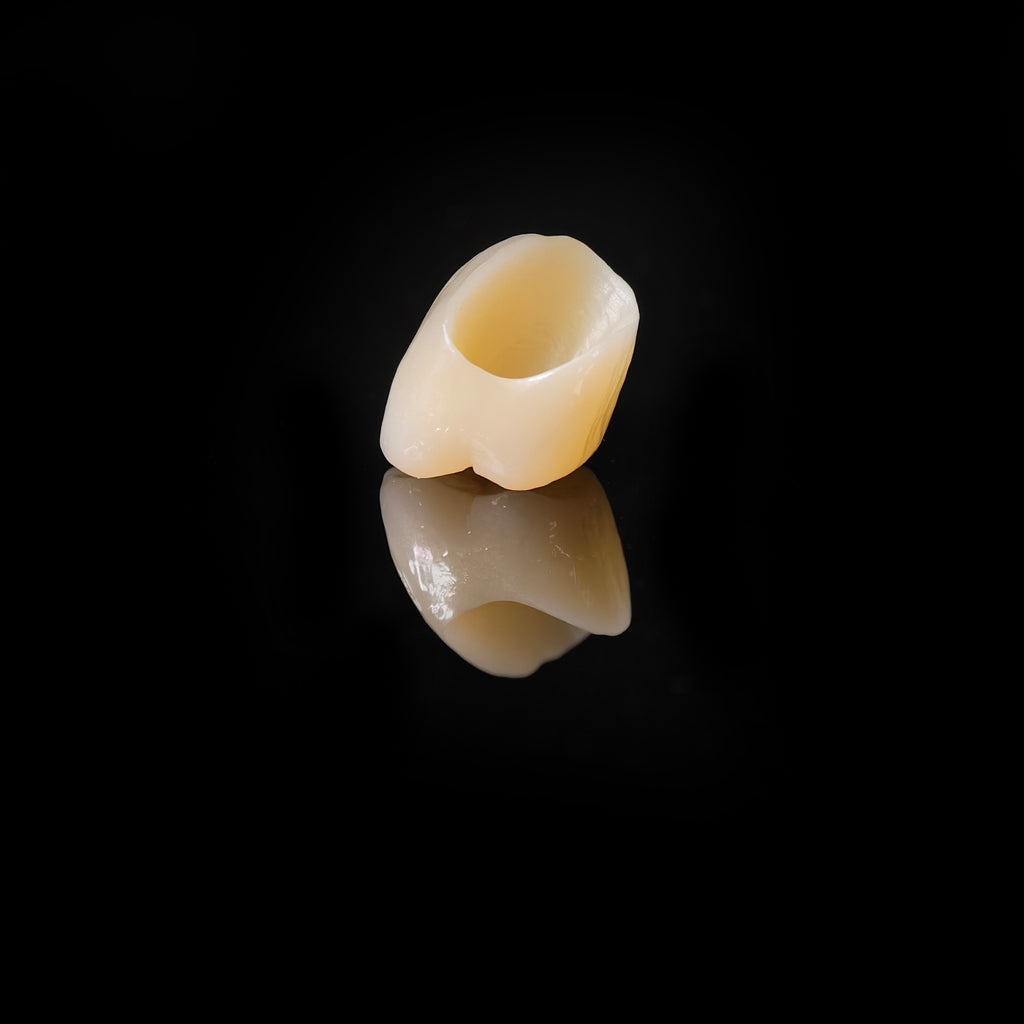 High - Strength Zirconia Dental Crown