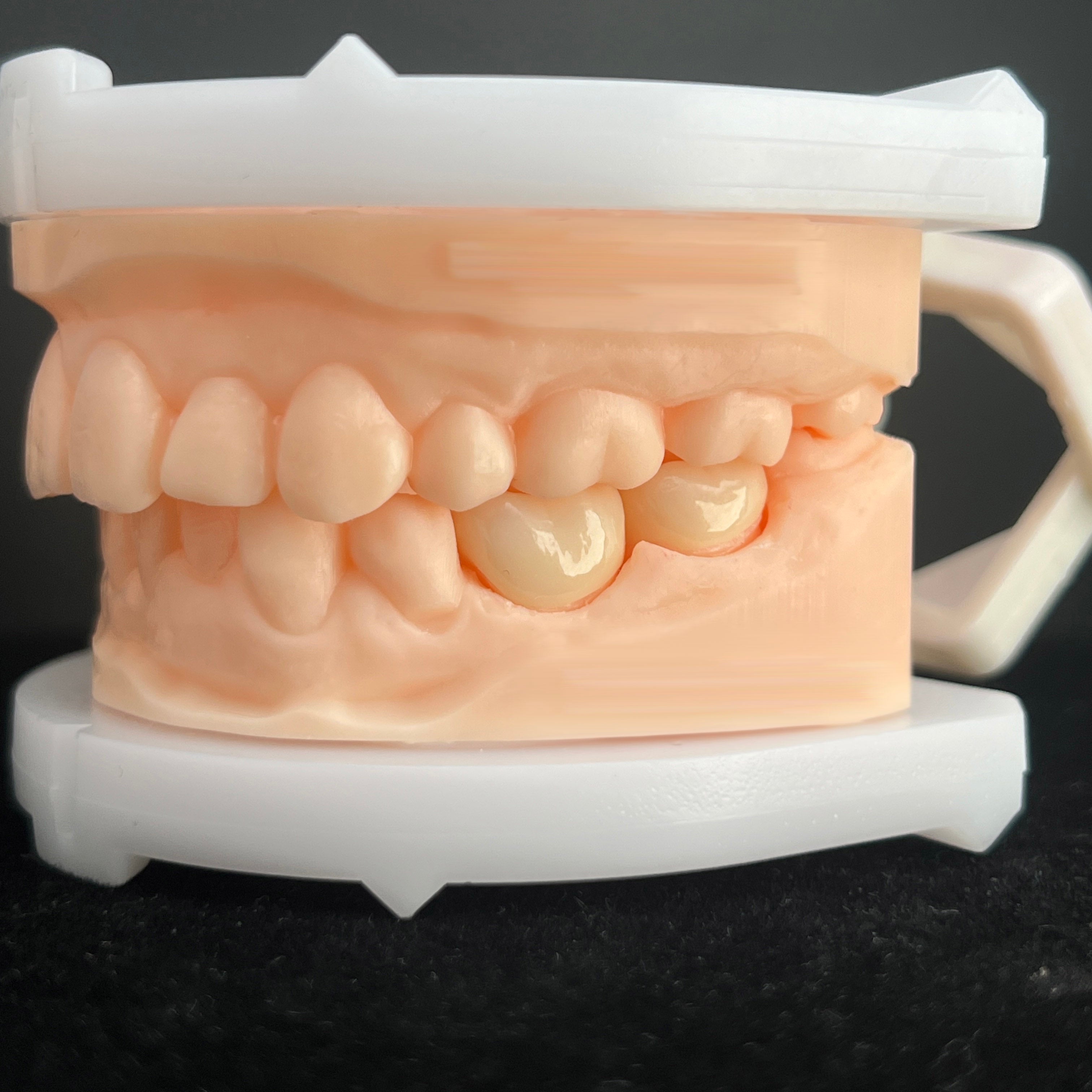 High - Strength Zirconia Dental Crowns