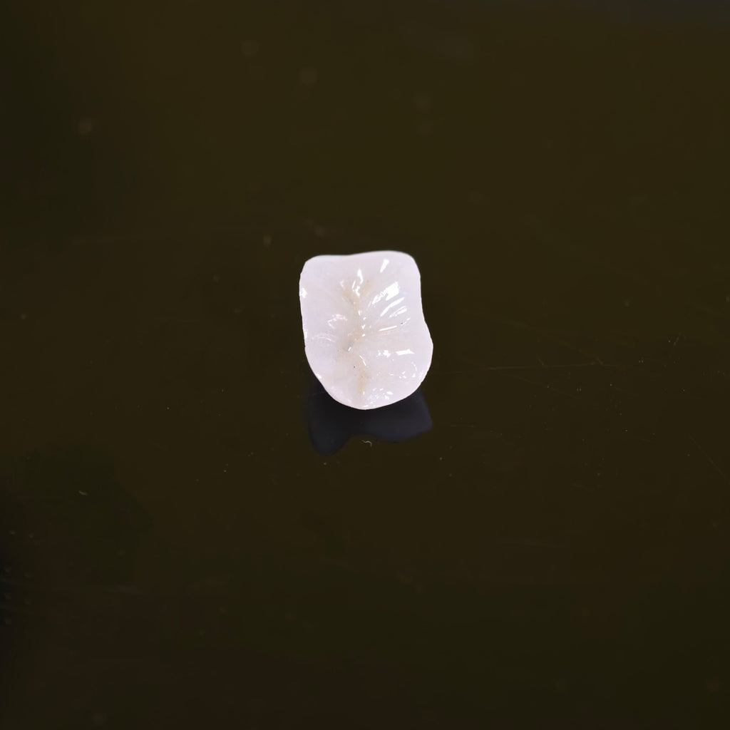 High - Strength Zirconia Inlay And Crown