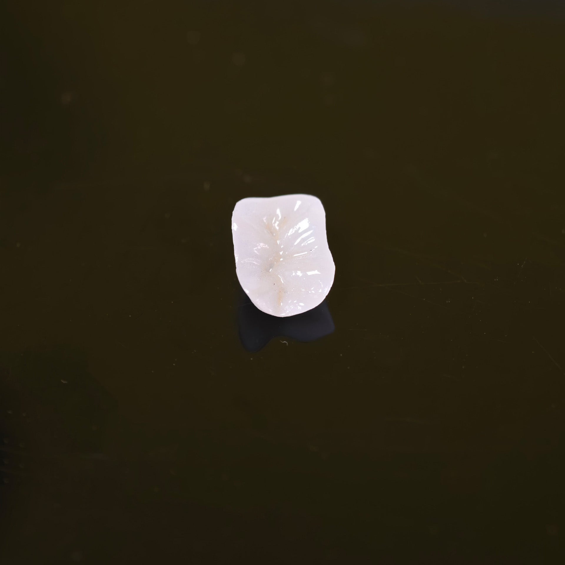 High - Strength Zirconia Inlay And Crown