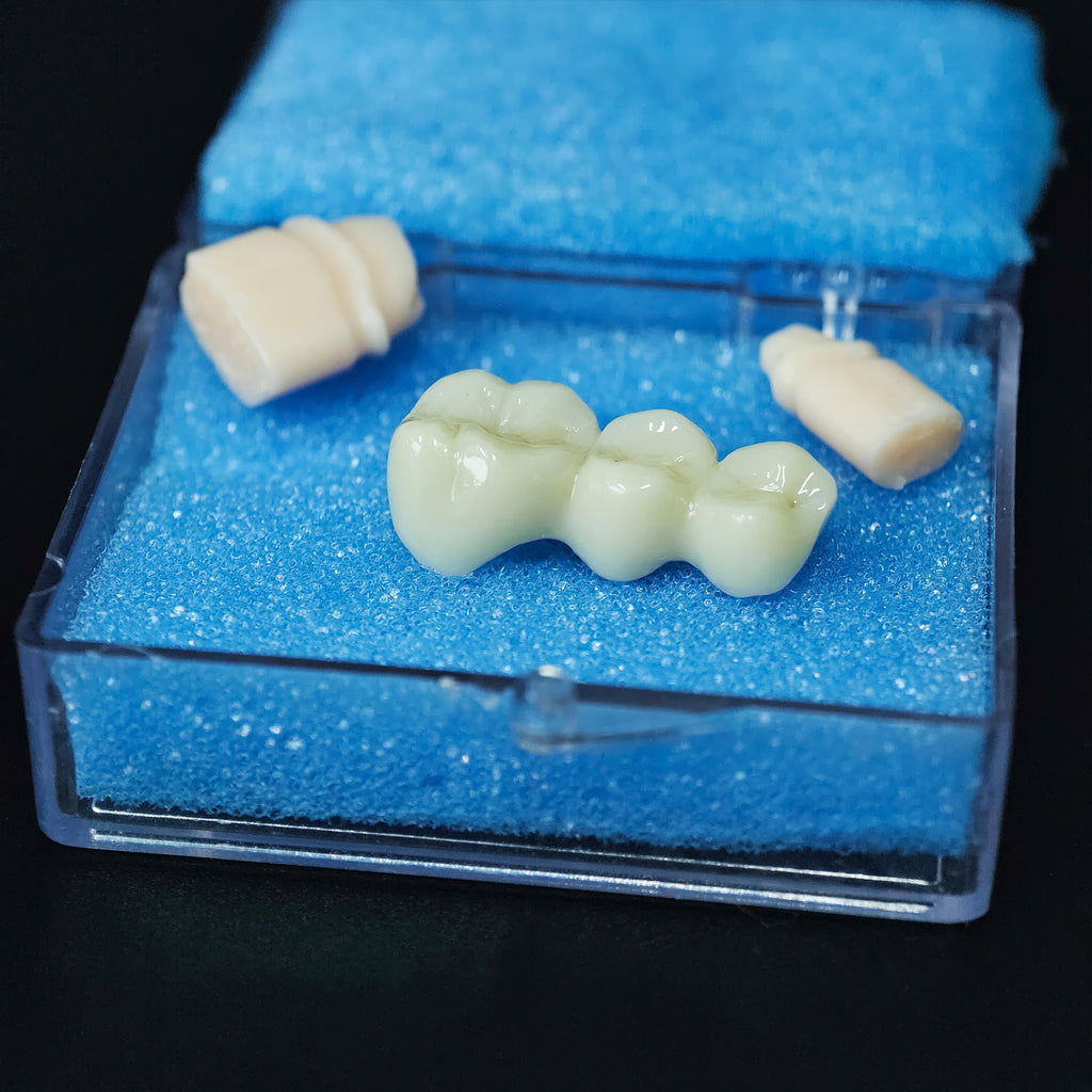 High - Strength Zirconia Bridge