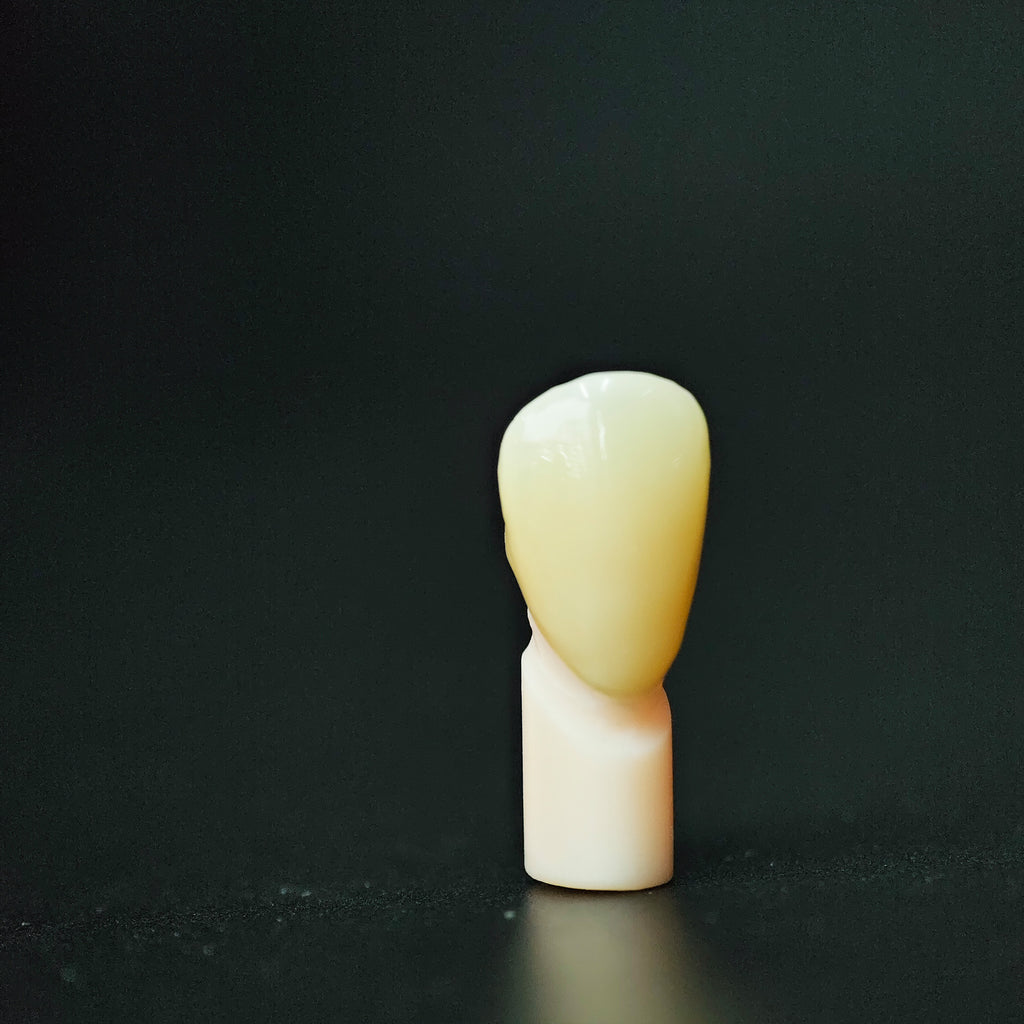 High - Strength Zirconia Crown