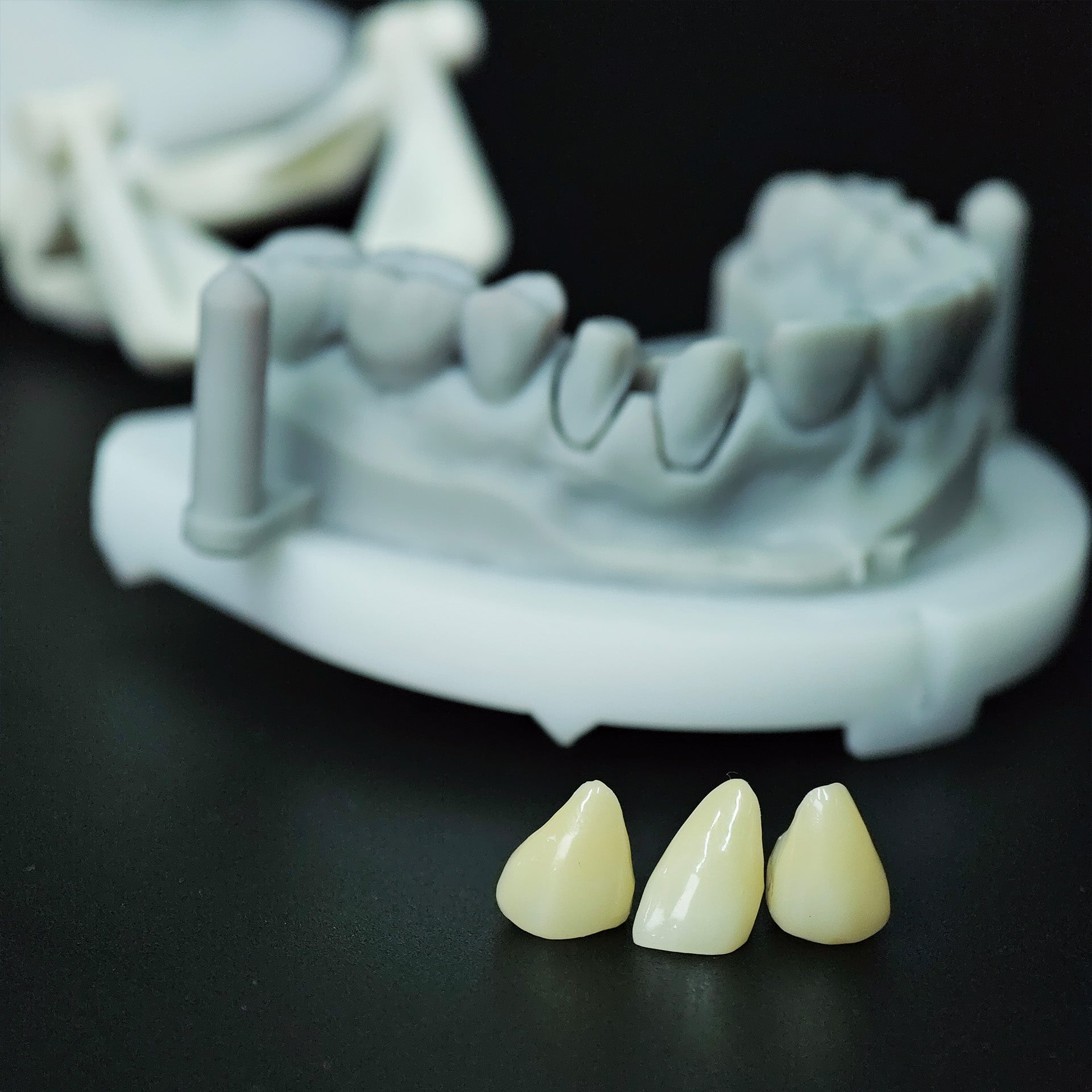 High - Strength Zirconia Crowns