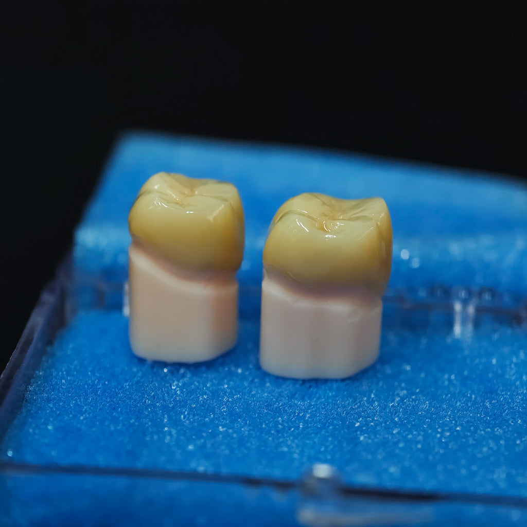 High - Strength Zirconia Crowns