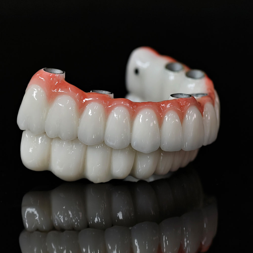 Implant-supported Co - Cr PFM Dental Bridge