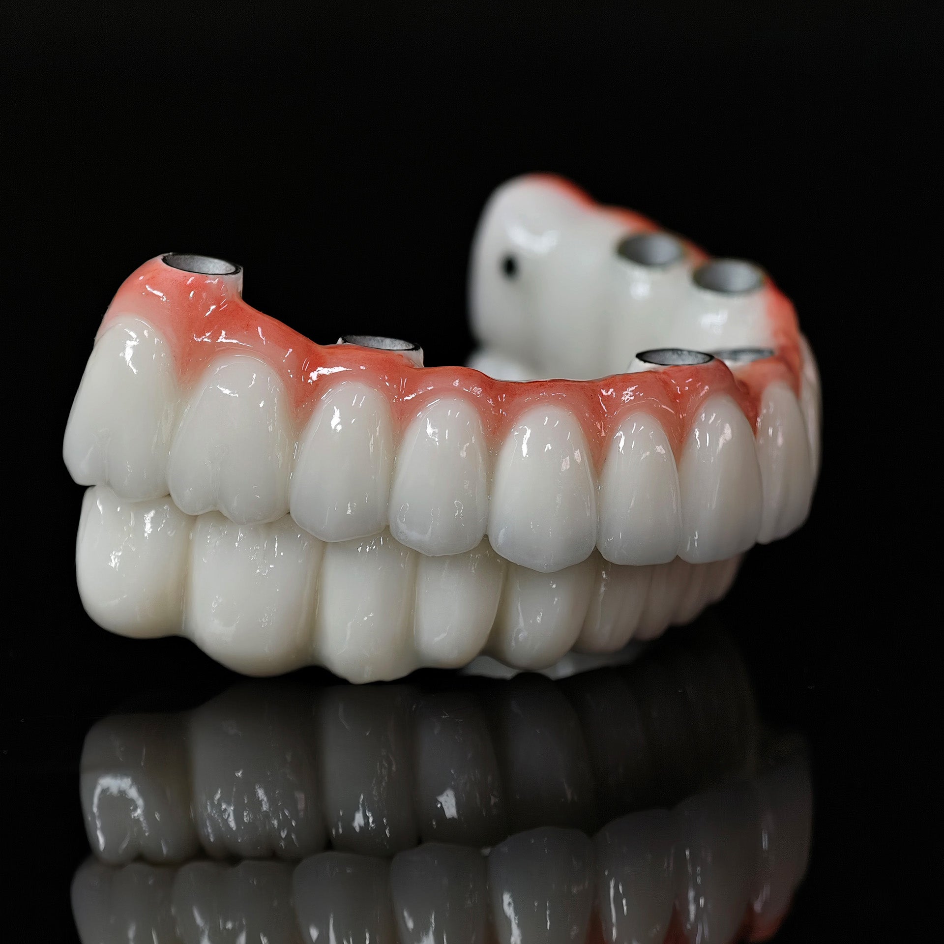 Implant-supported Co - Cr PFM Dental Bridge