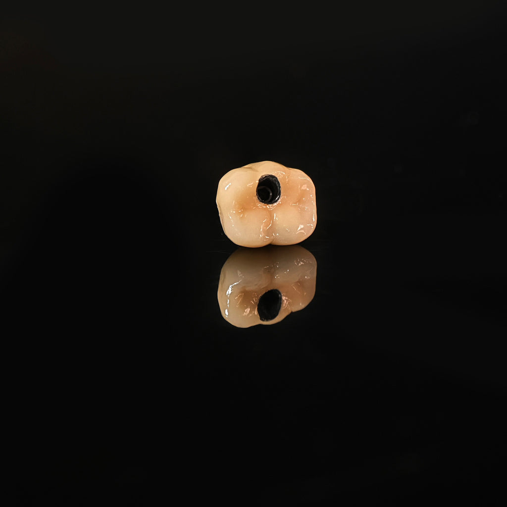 Implant-Supported PFM Single Crown