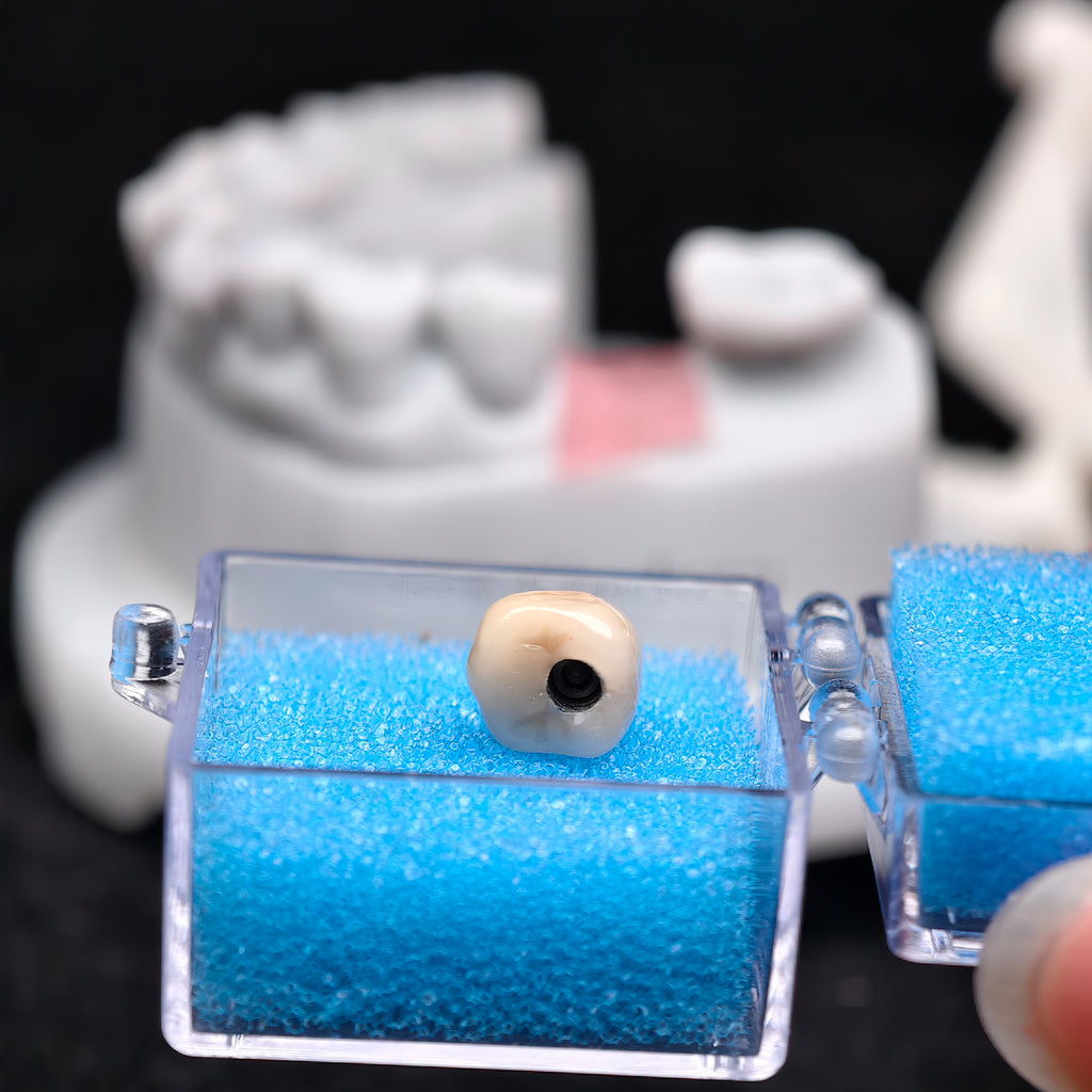Implant-Supported PFM Single Crown