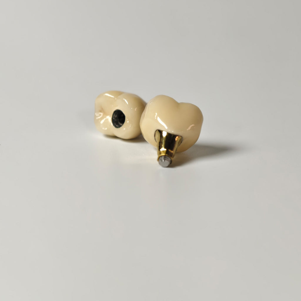 Implant-Supported PFM Single Crowns