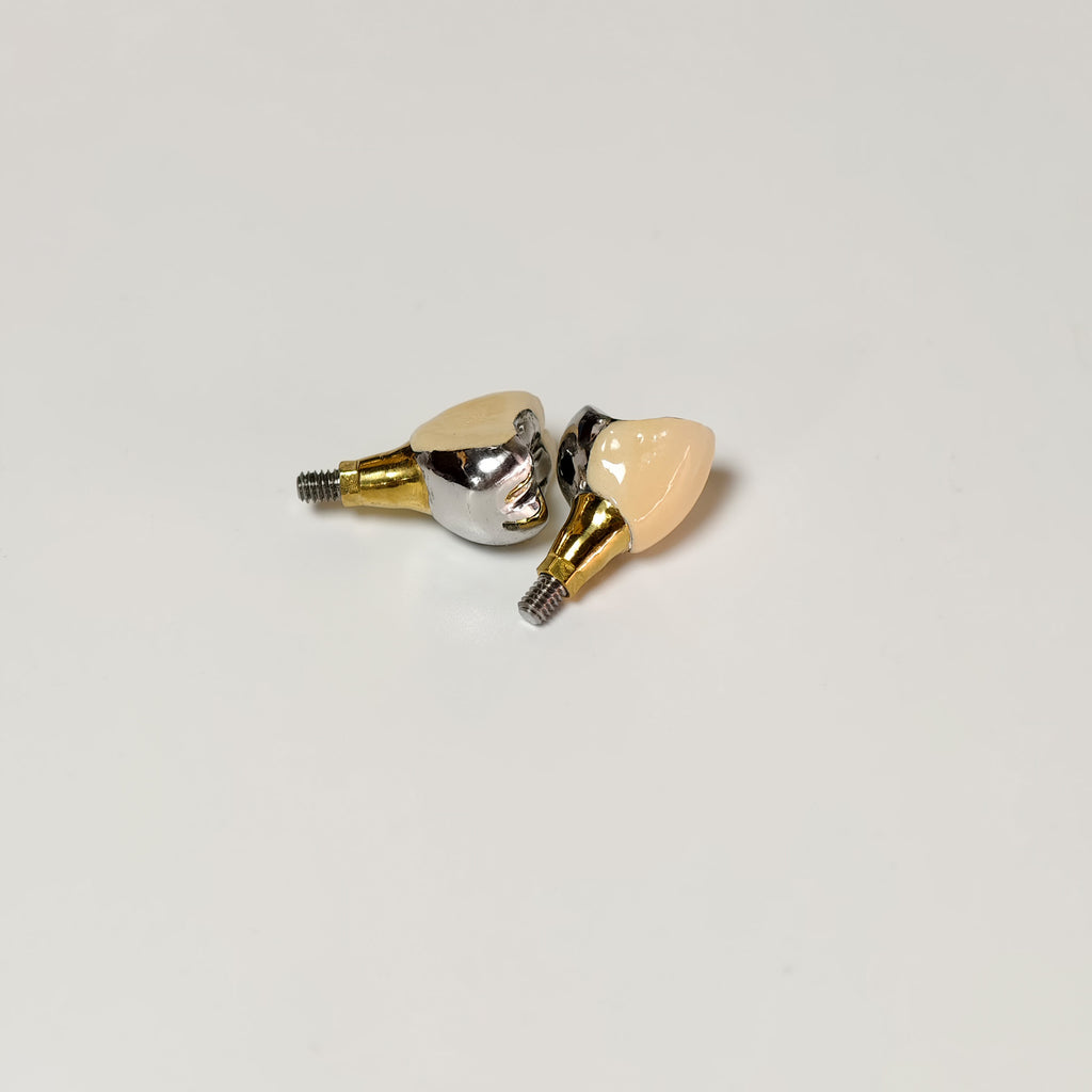 Implant-Supported PFM Single Crowns With Metal