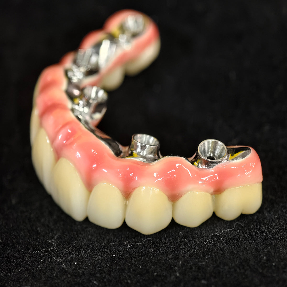 Malo Bridge With Exposed Titanium Framework