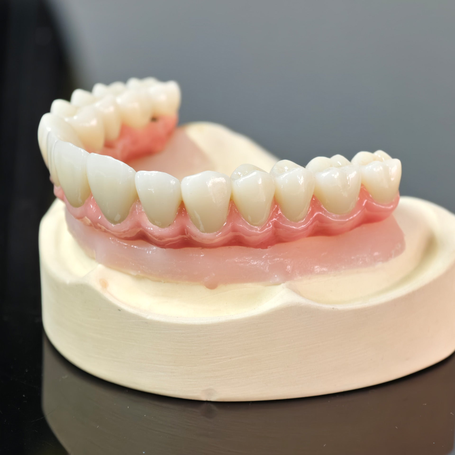 Malo Bridge With Gold-Plated Grade 5 Pure Titanium Malo Bridge