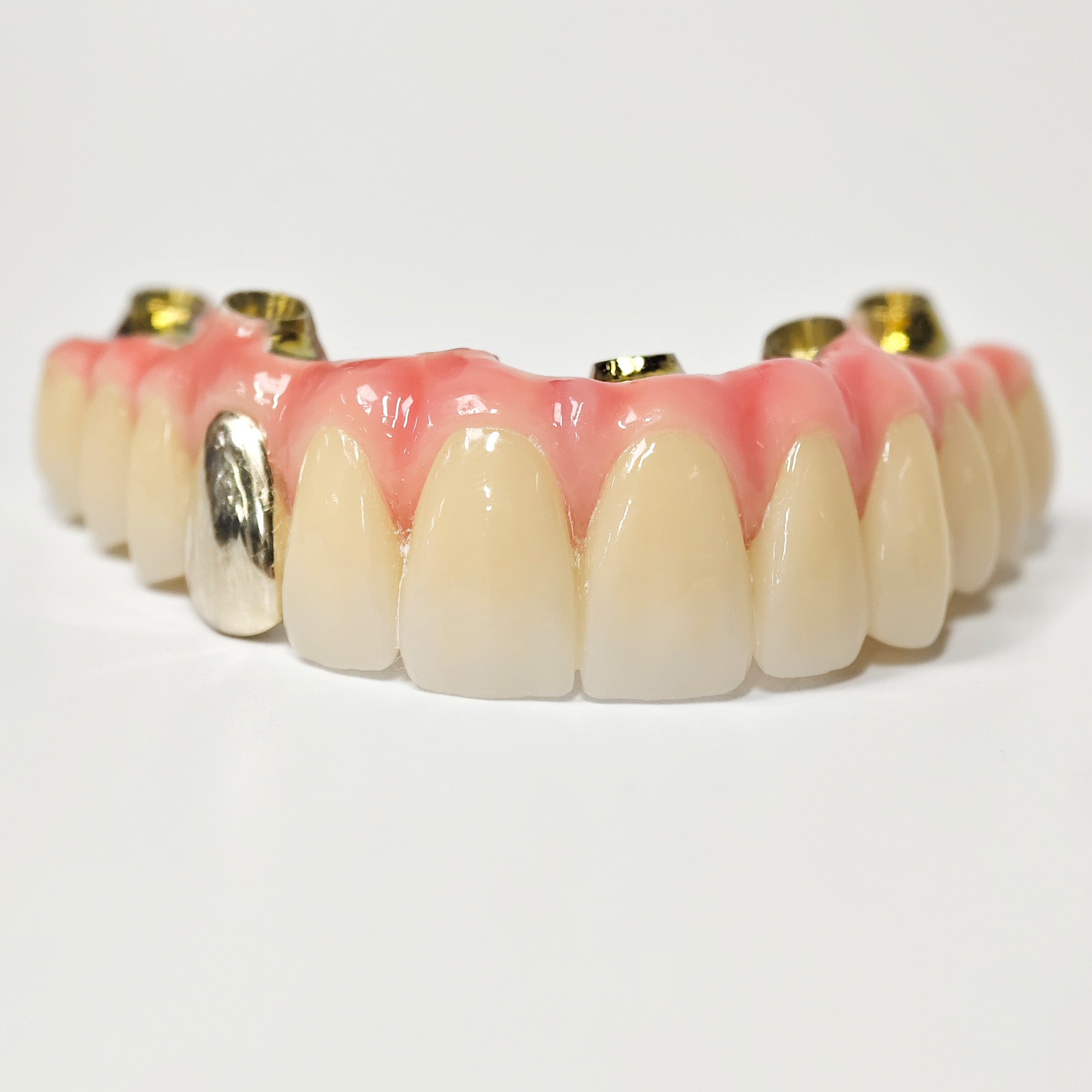 Malo Bridge With Gold-Plated Titanium Framework And A Gold Crown