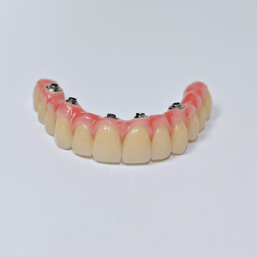 Malo Bridge With Screw-Retained