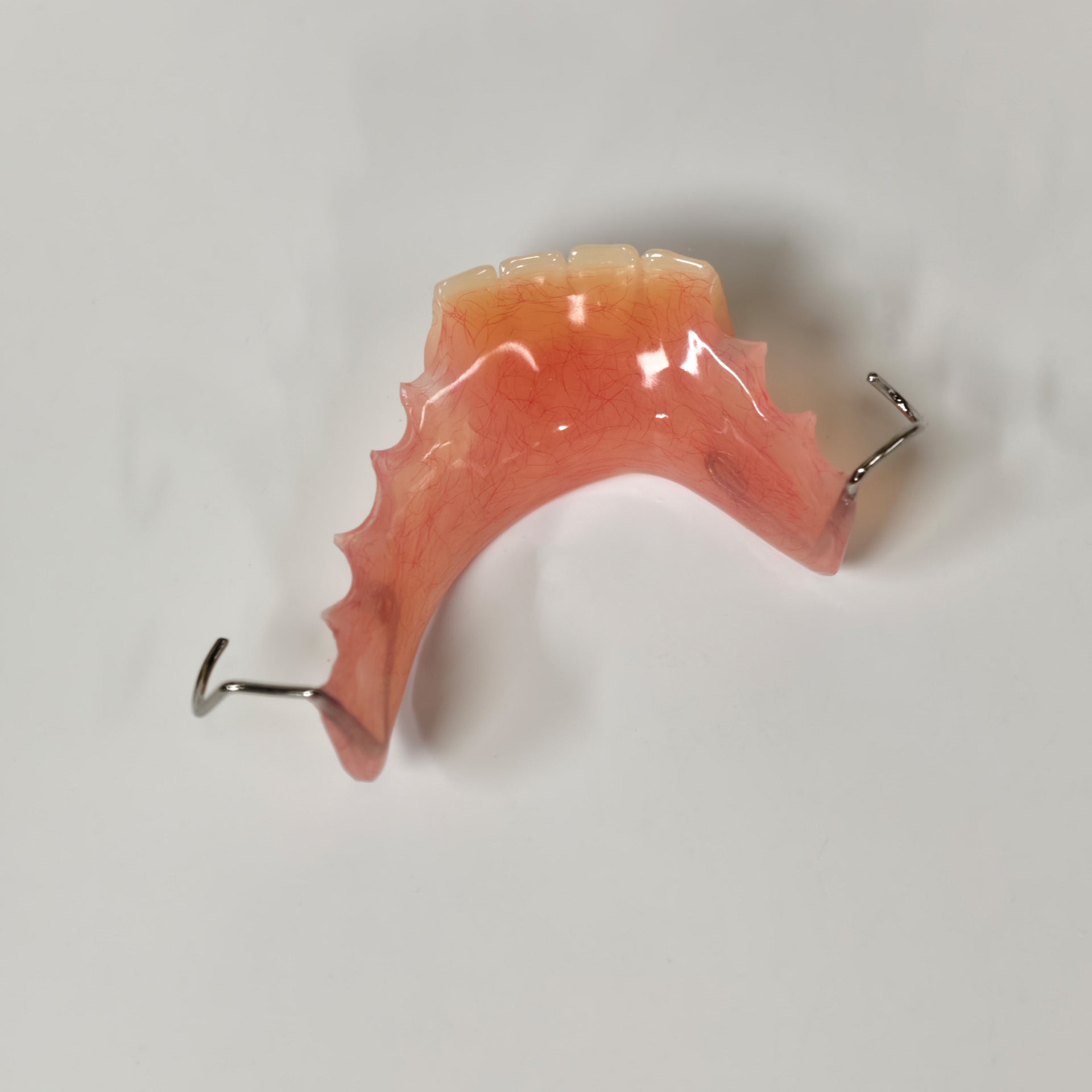 Metal Clasp Partial Denture
