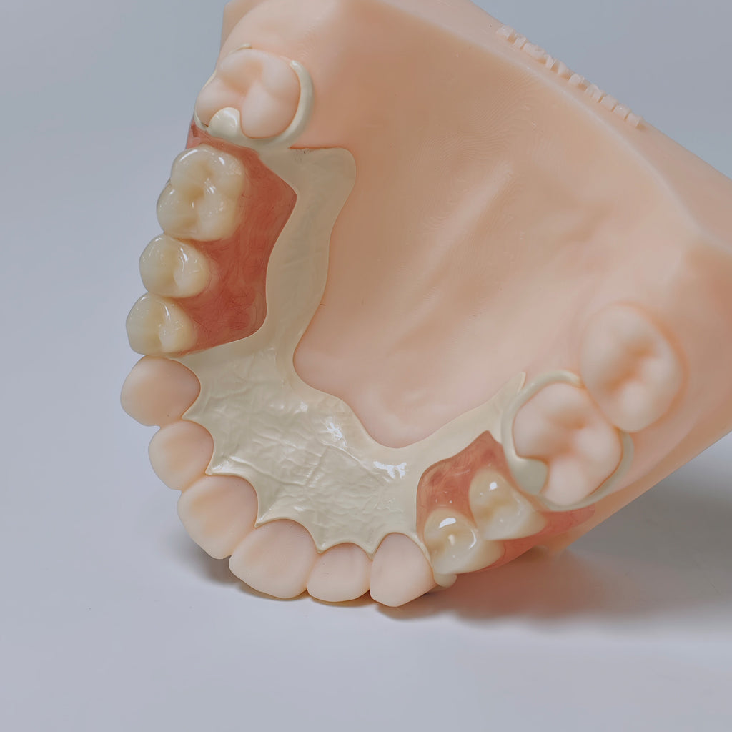 PEEK Framework Denture Metal Framework With Acrylic Denture