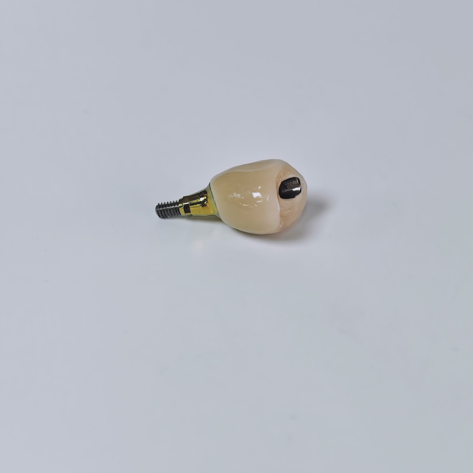 PFM Crown With Screw Retained