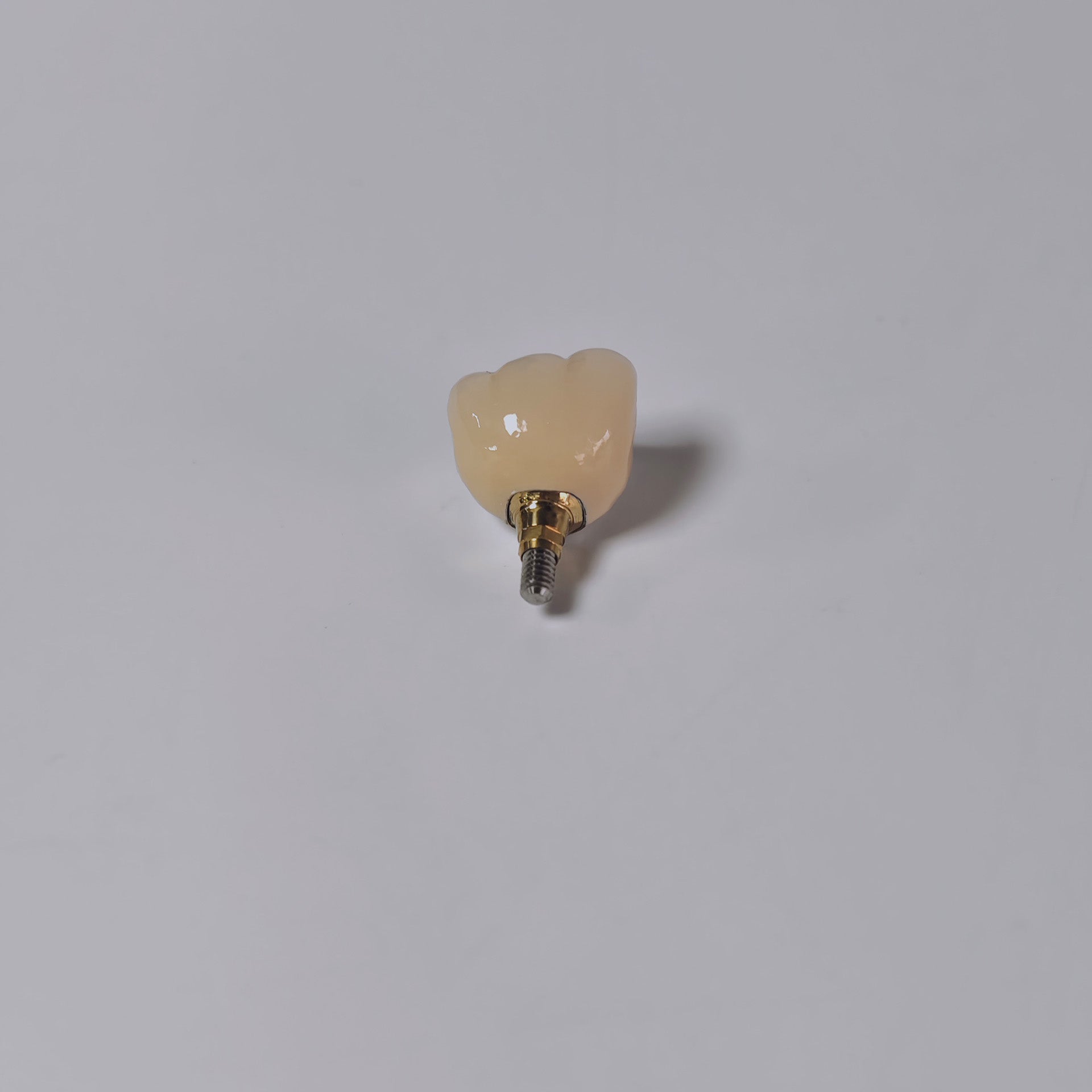 PFM Crown With Screw Retained