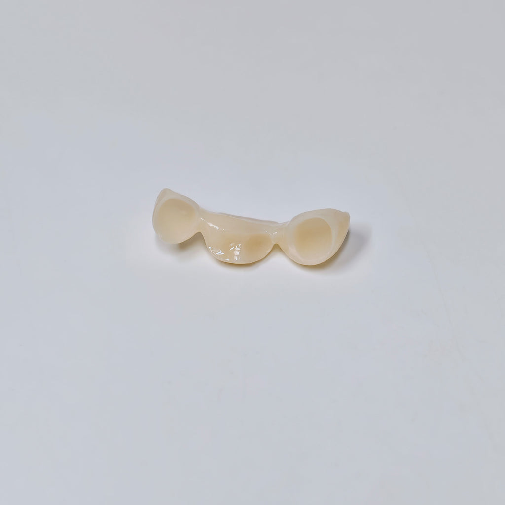PFZ Dental Bridge – Depth And Aesthetics