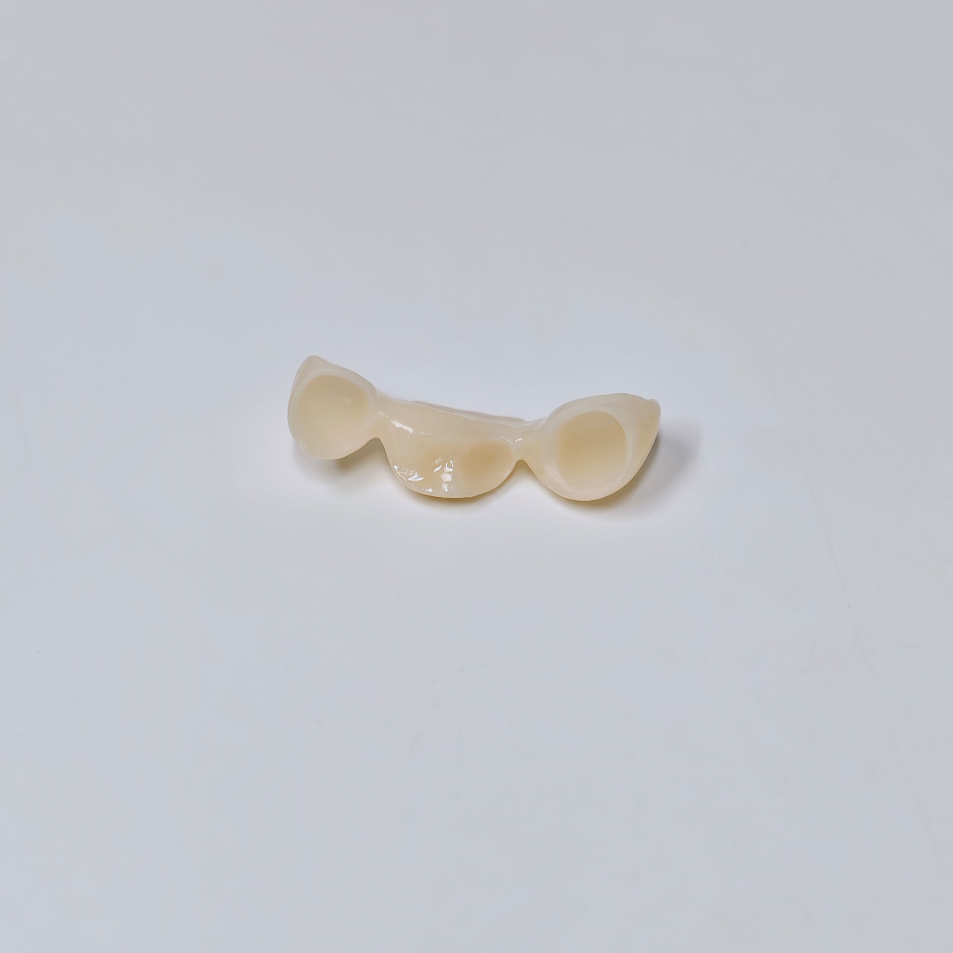 PFZ Dental Bridge – Depth And Aesthetics