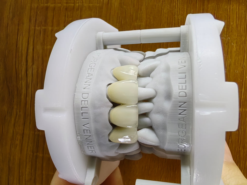 PFZ With Transparent In Incisal