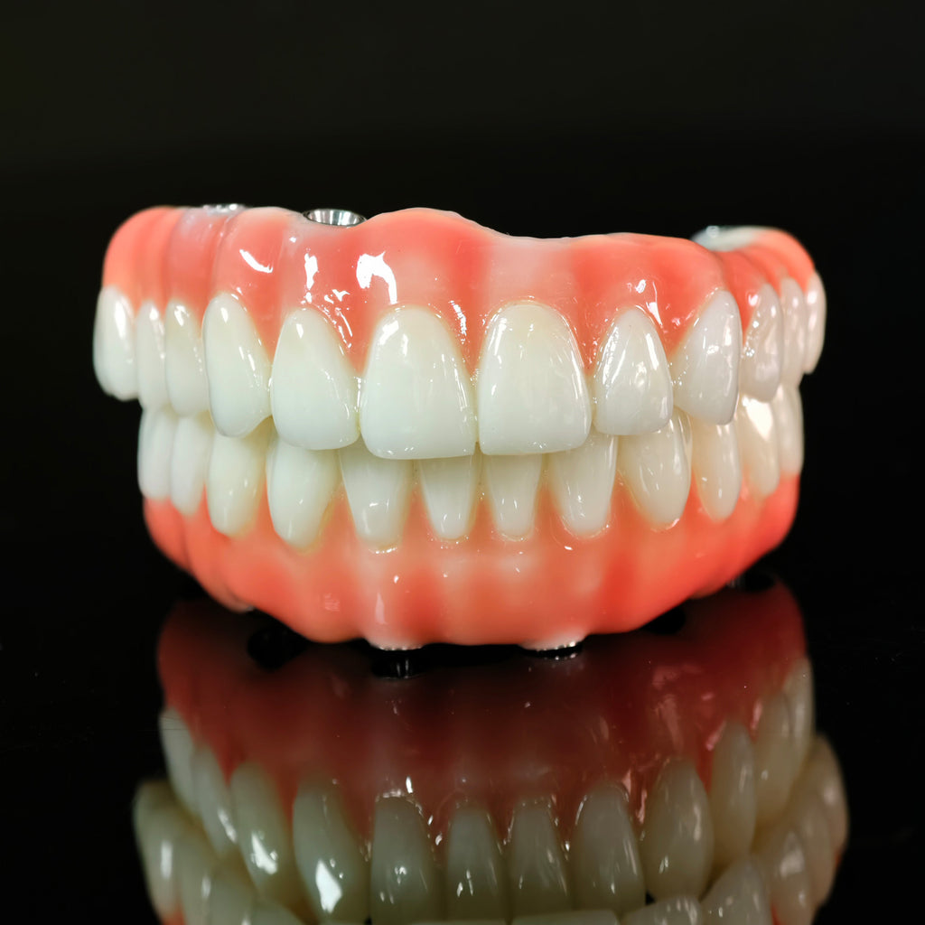 PMMA Bridge With Ti-Base Screw Retained Trying For Full Arch Restoration
