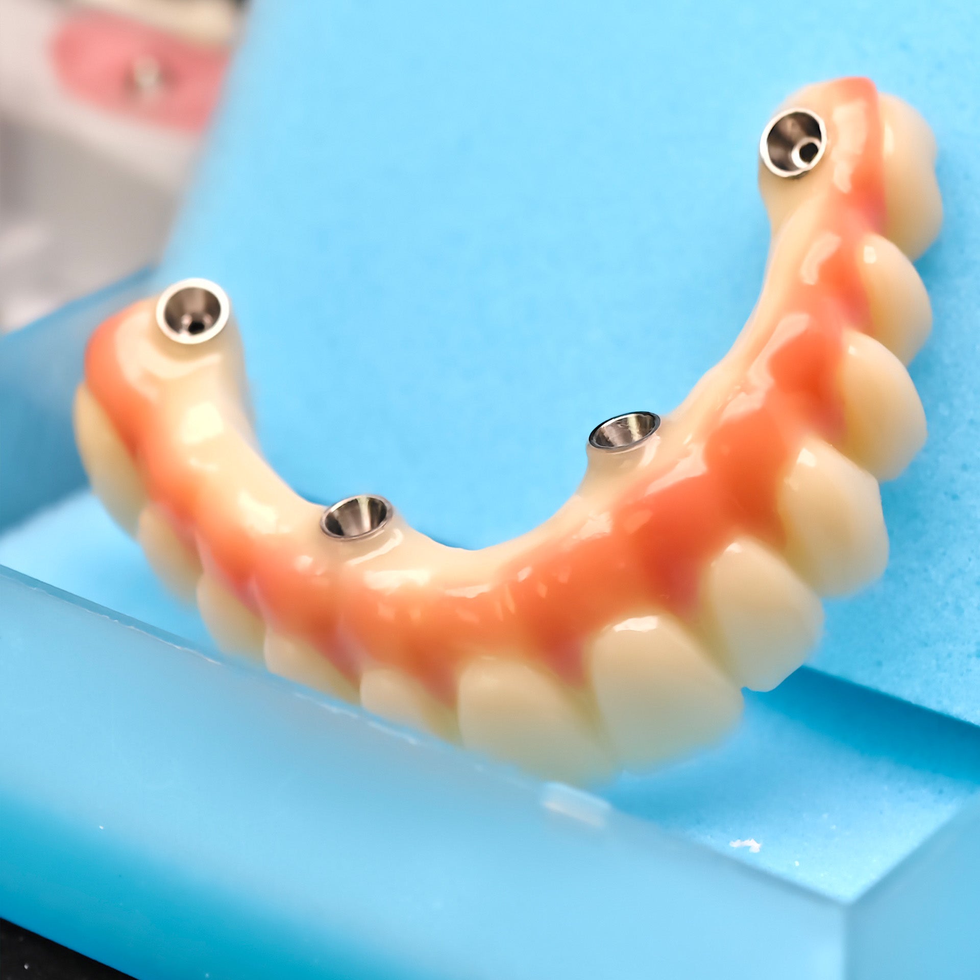 PMMA Bridge With Ti-Base Screw Retained Trying For Full Arch Restoration