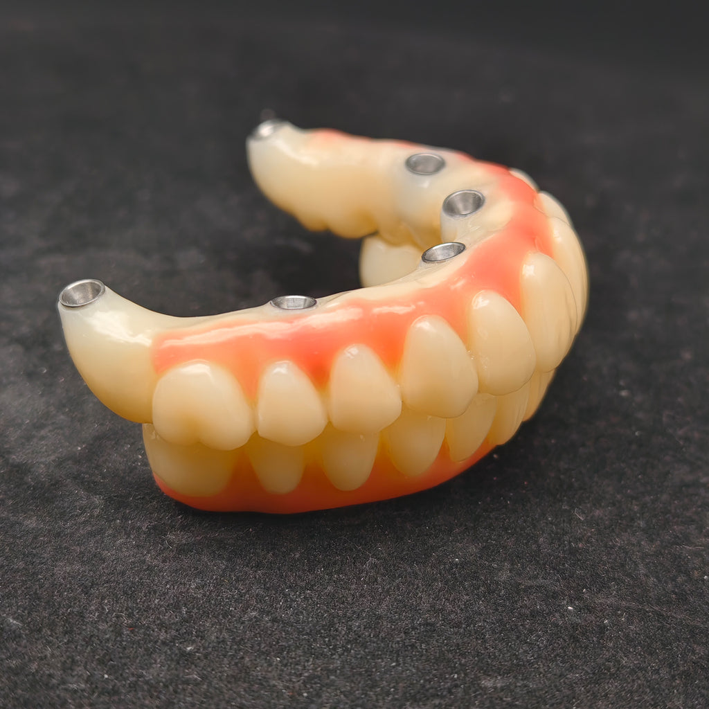 PMMA Bridge With Ti-Base Screw Retained Trying For Full Arch Restoration