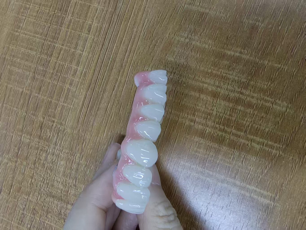 PMMA Bridge With Ti-Base Screw Retained Trying For Full Arch Restoration
