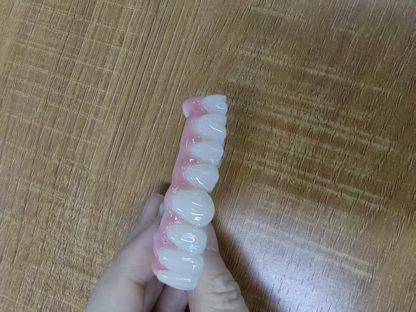 PMMA Bridge With Ti-Base Screw Retained Trying For Full Arch Restoration