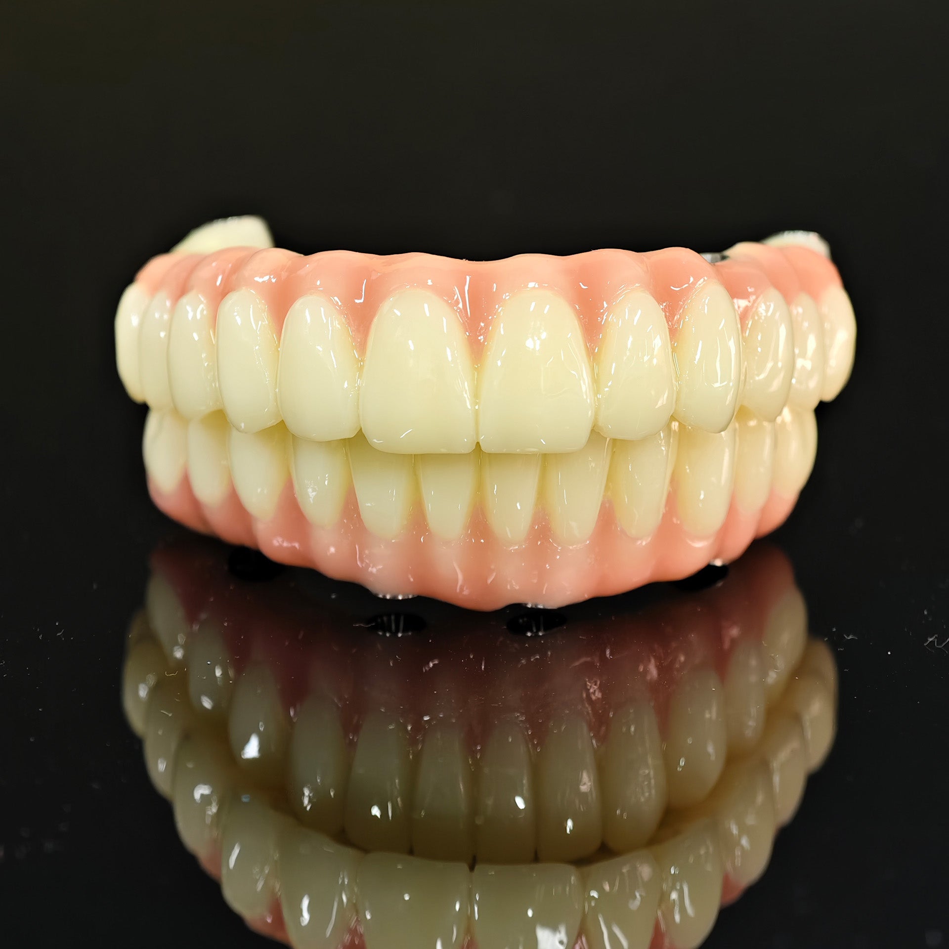 PMMA Bridge With Ti-Base Screw Retained Trying For Full Arch Restoration
