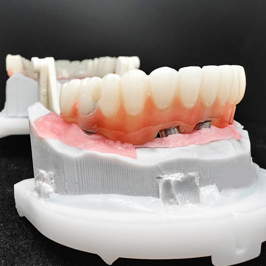 PMMA Bridge With Ti-Base Screw Retained Trying For Full Arch Restoration