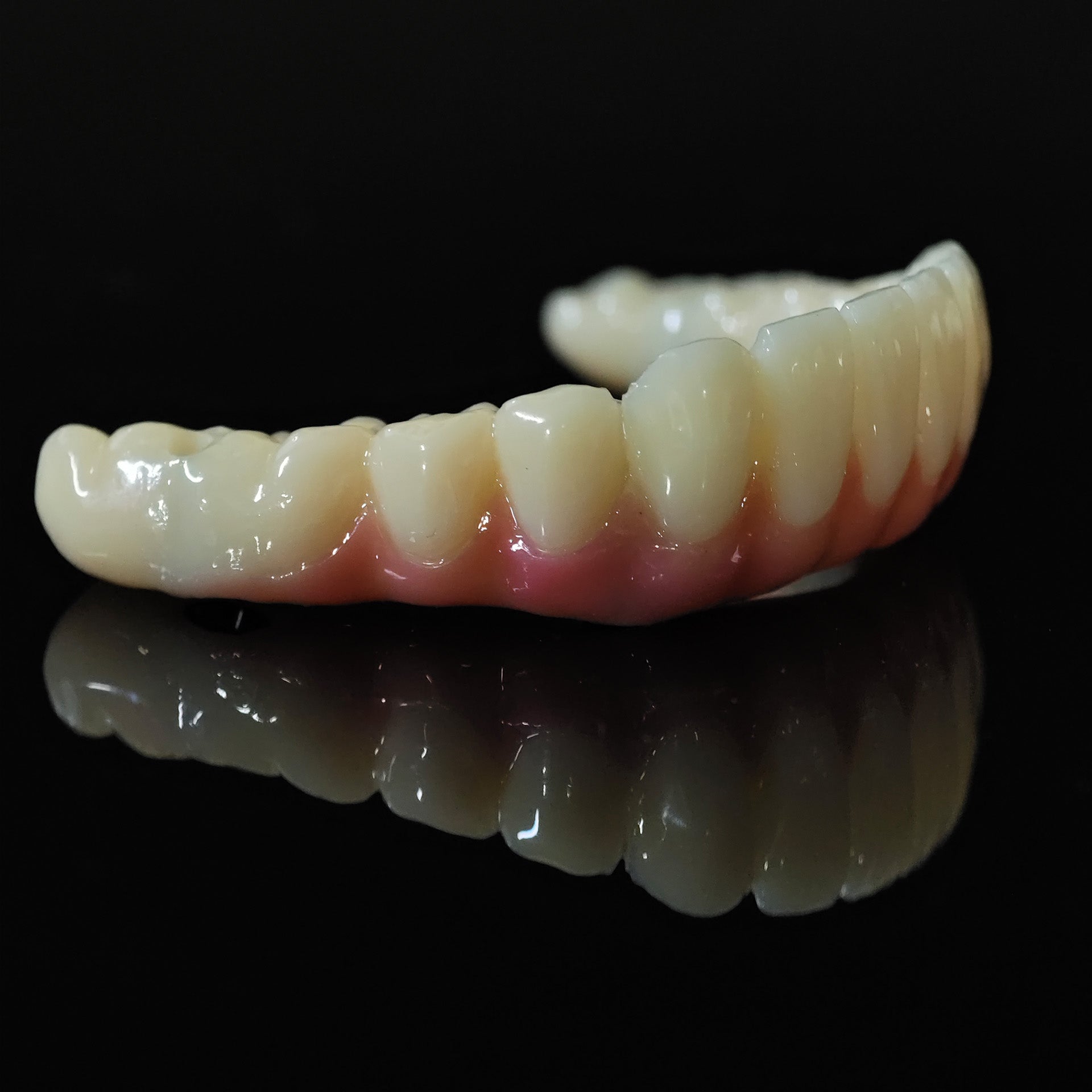 PMMA Bridge With Ti-Base Screw Retained Trying For Full Arch Restoration