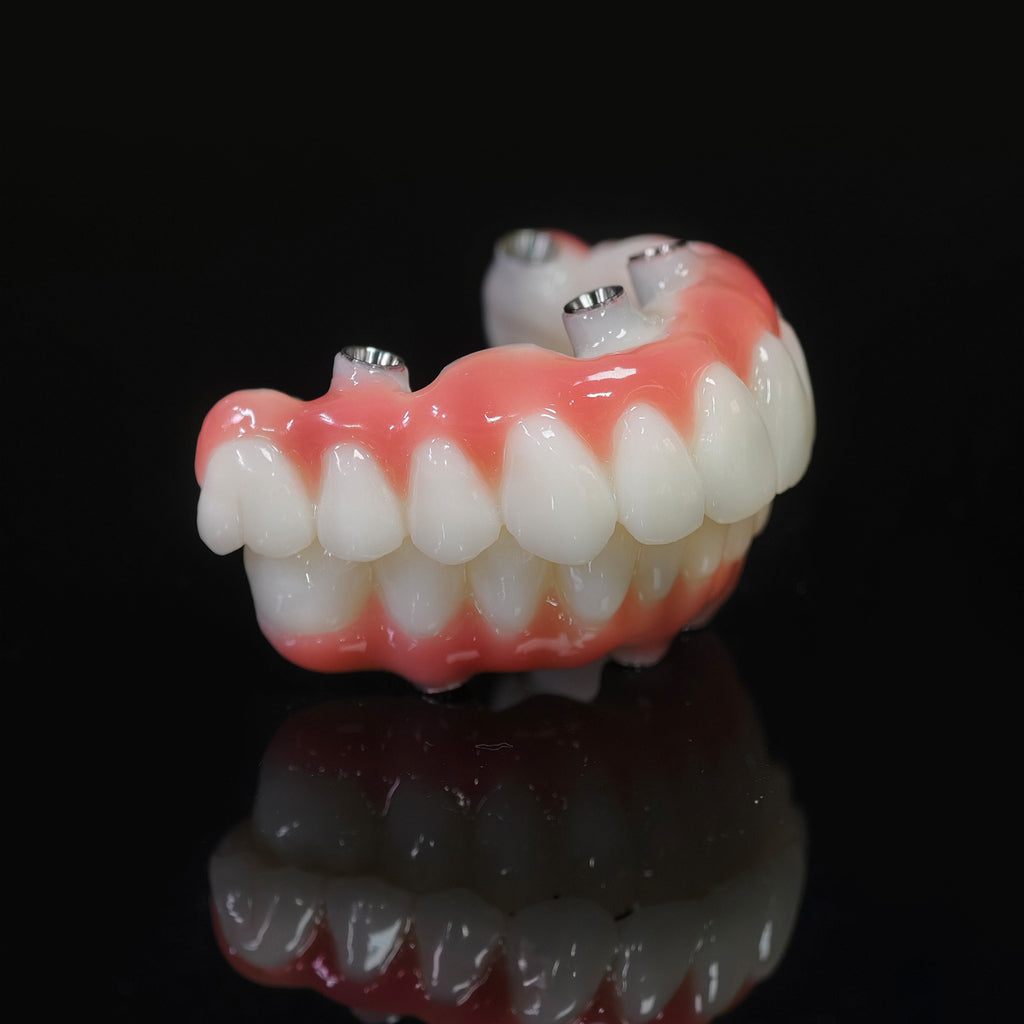 PMMA Bridge With Ti-Base Screw Retained Trying For Full Arch Restoration