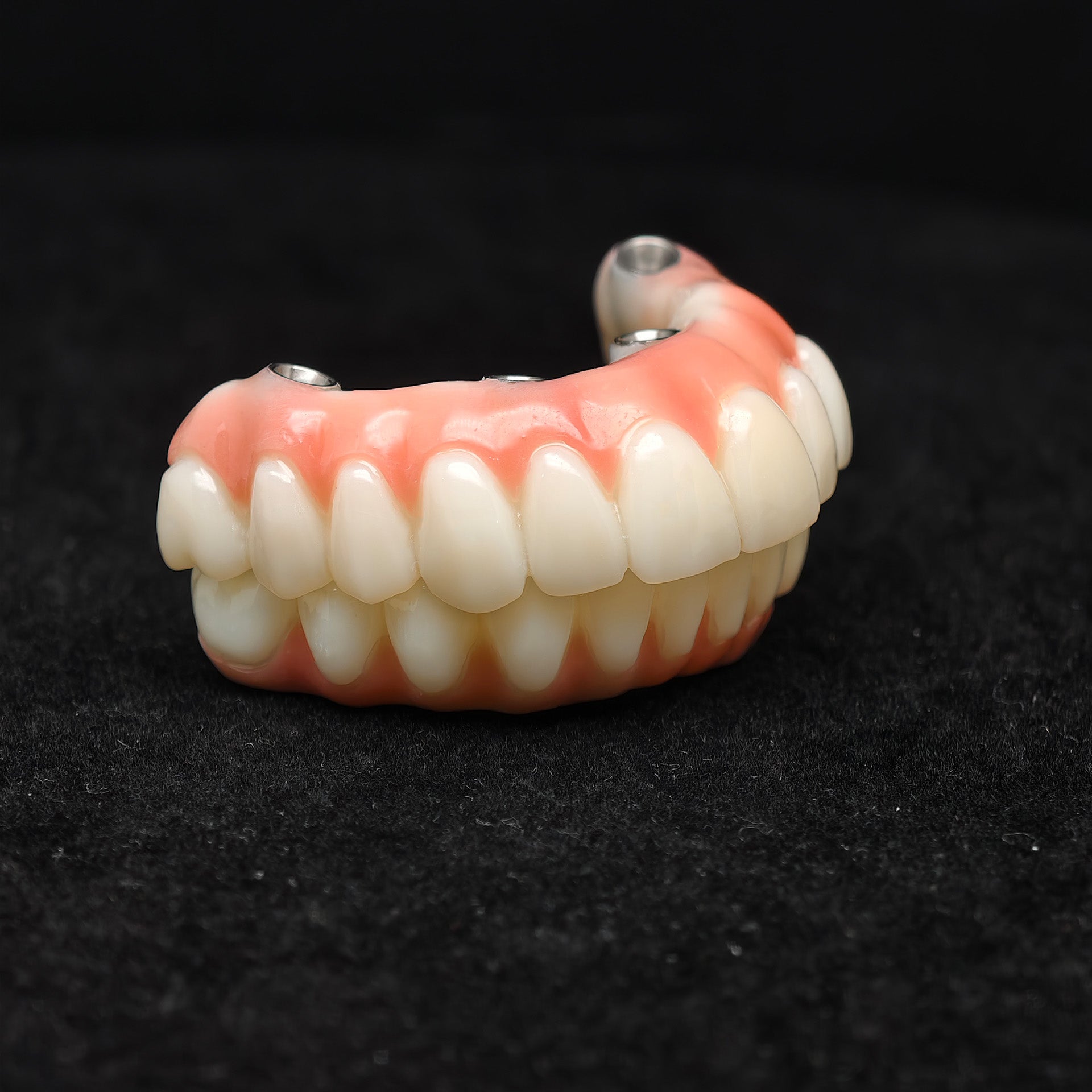 PMMA Bridge With Ti-Base Screw Retained Trying For Full Arch Restoration