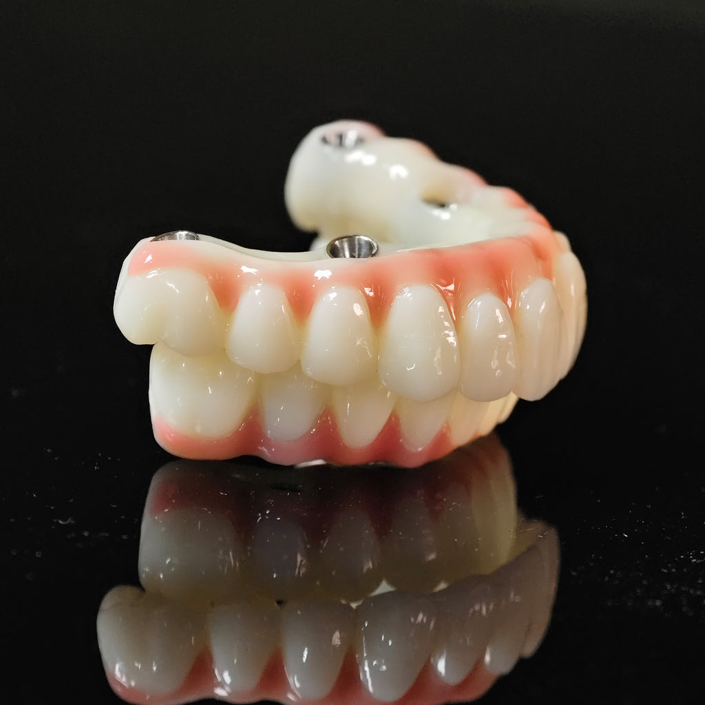PMMA Bridge With Ti-Base Screw Retained Trying For Full Arch Restoration