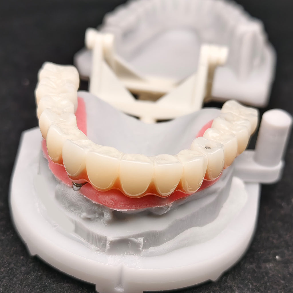 PMMA Bridge With Ti-Base Screw Retained Trying For Full Arch Restoration
