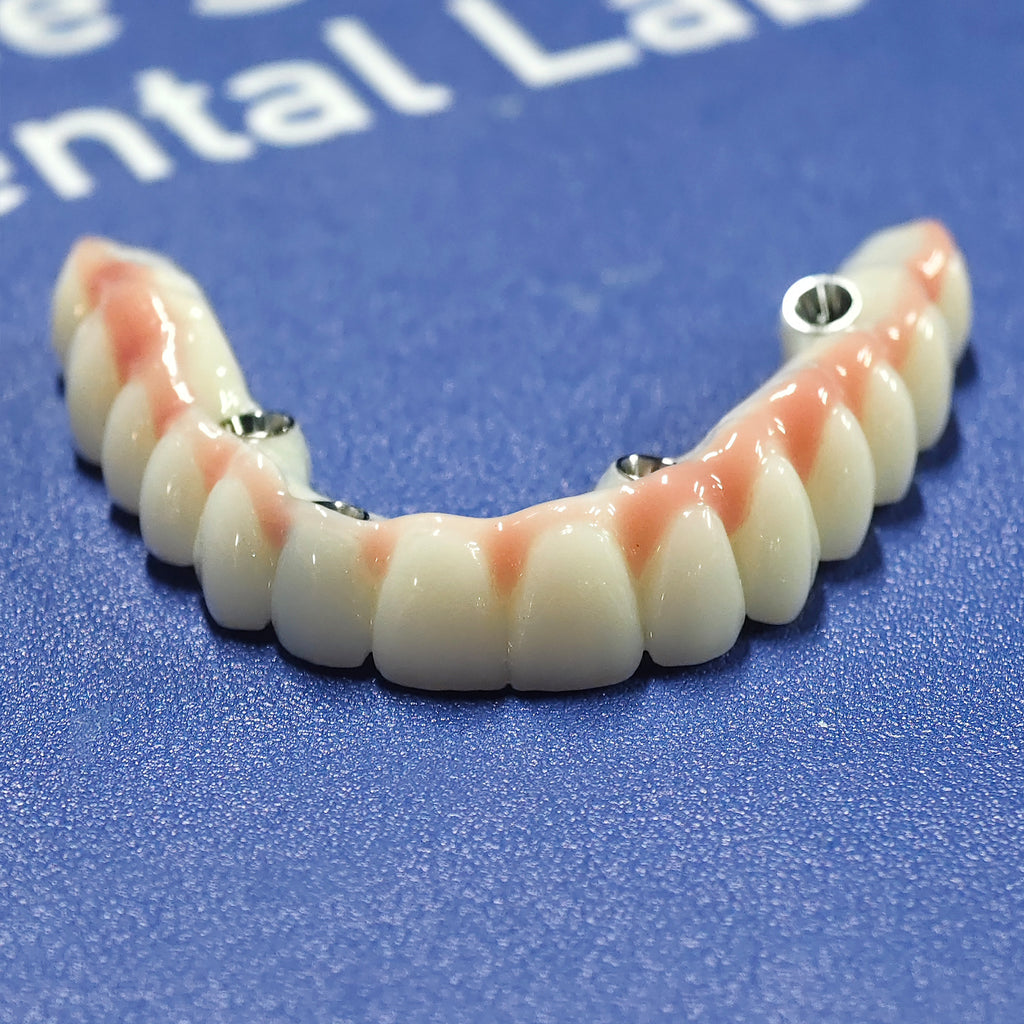 PMMA Bridge With Ti-Base Screw Retained Trying For Full Arch Restoration