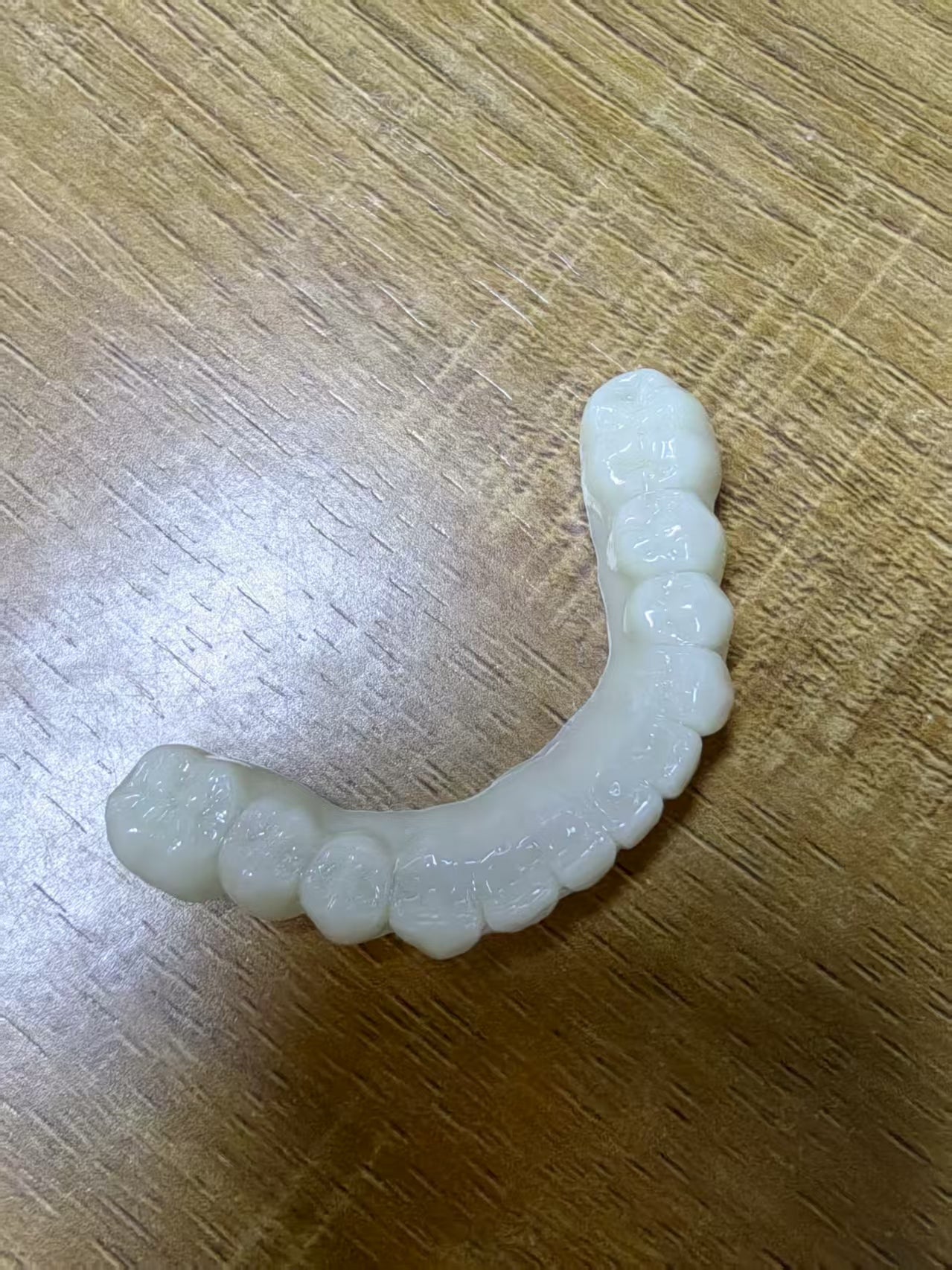 PMMA Bridge With Open Shell Preparing For Full Arch Dental Implants