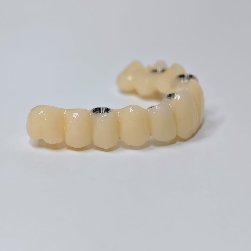 PMMA Bridge With Screw Retained