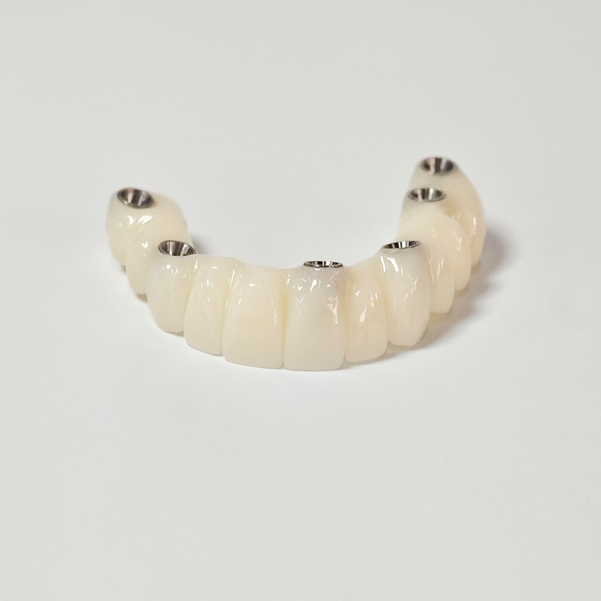 PMMA Bridge With Screw Retained