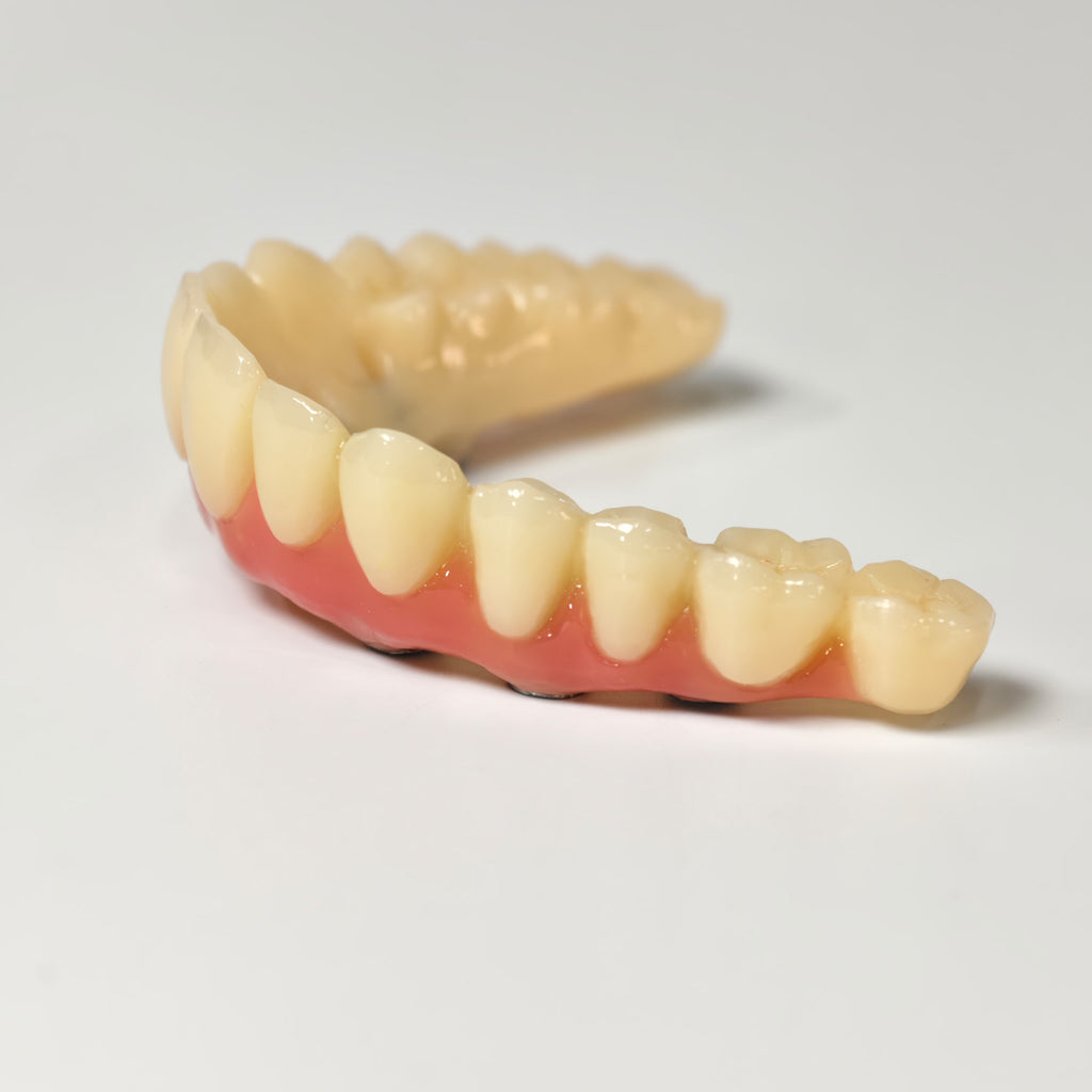 PMMA Bridge With Screw Retained