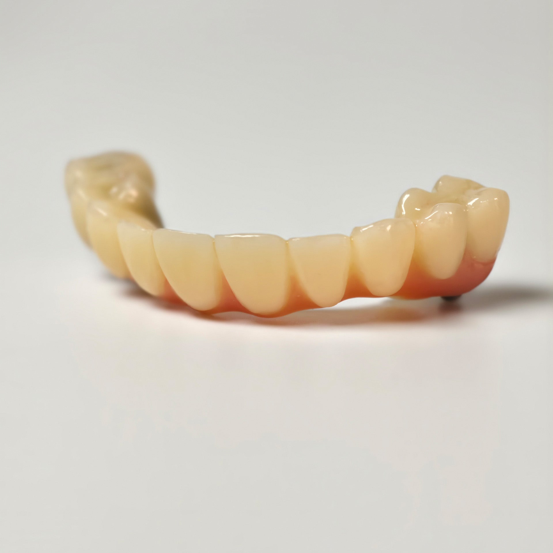 PMMA Bridge With Screw Retained