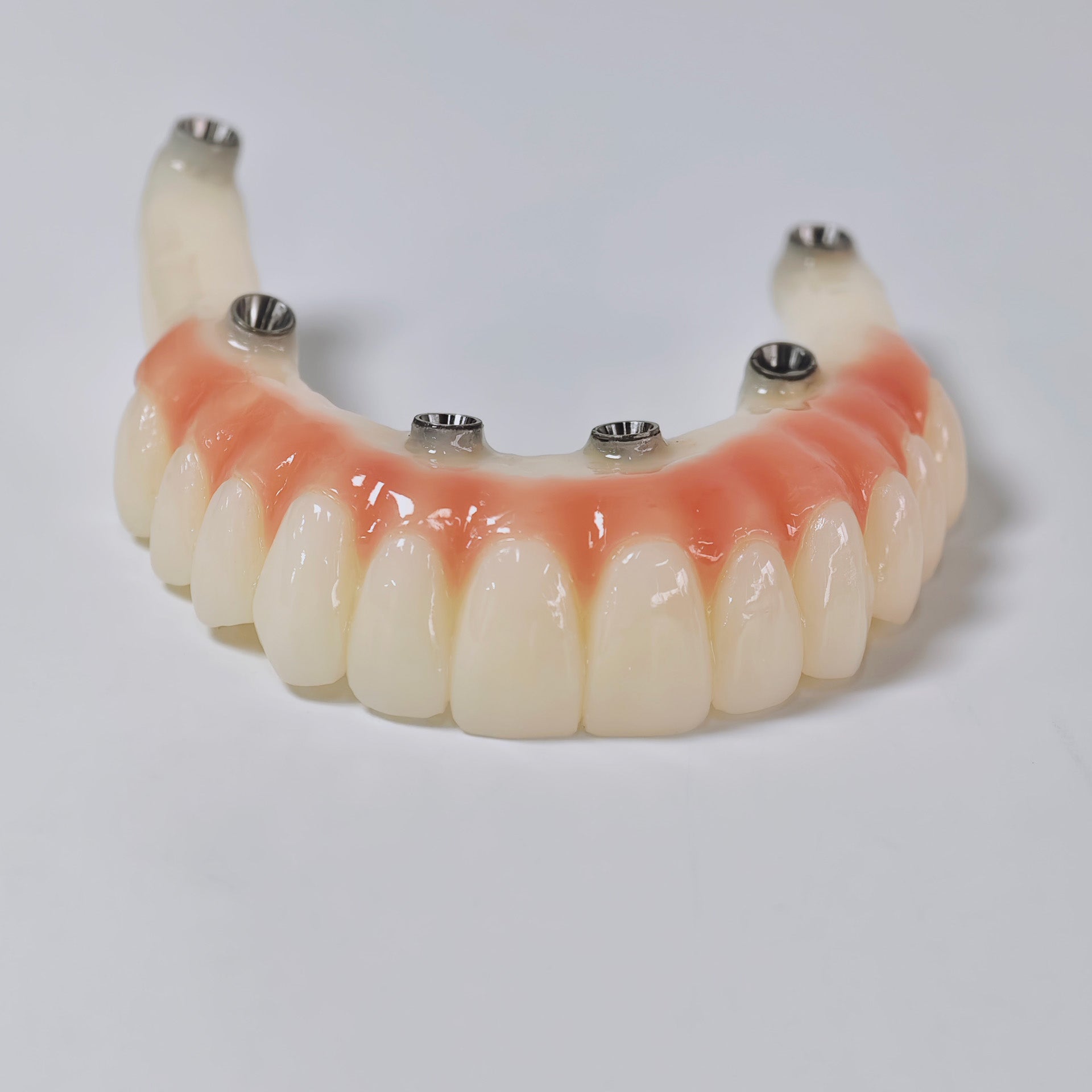 PMMA Bridge With Screw Retained