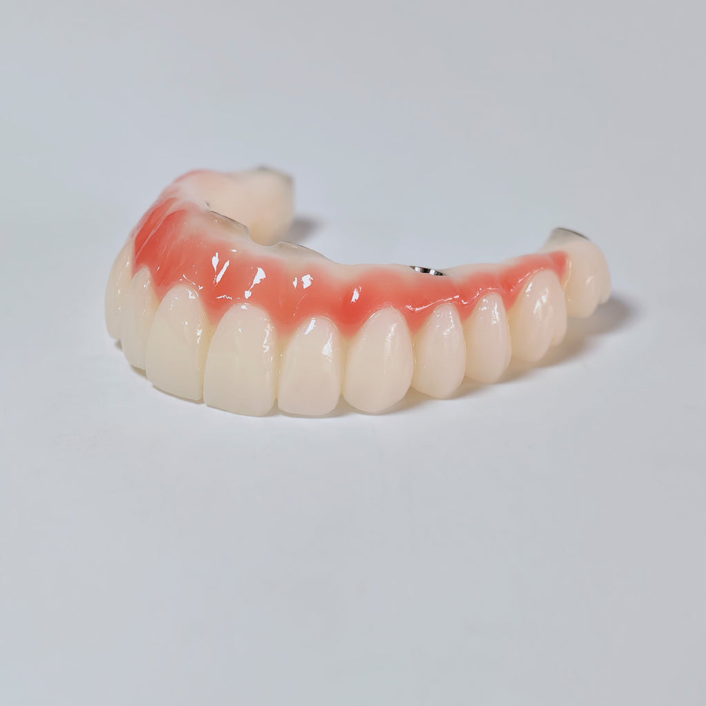 PMMA Bridge With Screw Retained