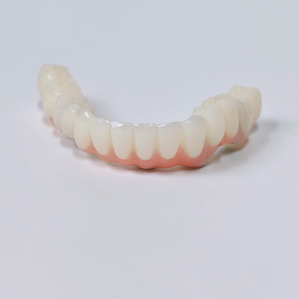 PMMA Bridge With Screw Retained