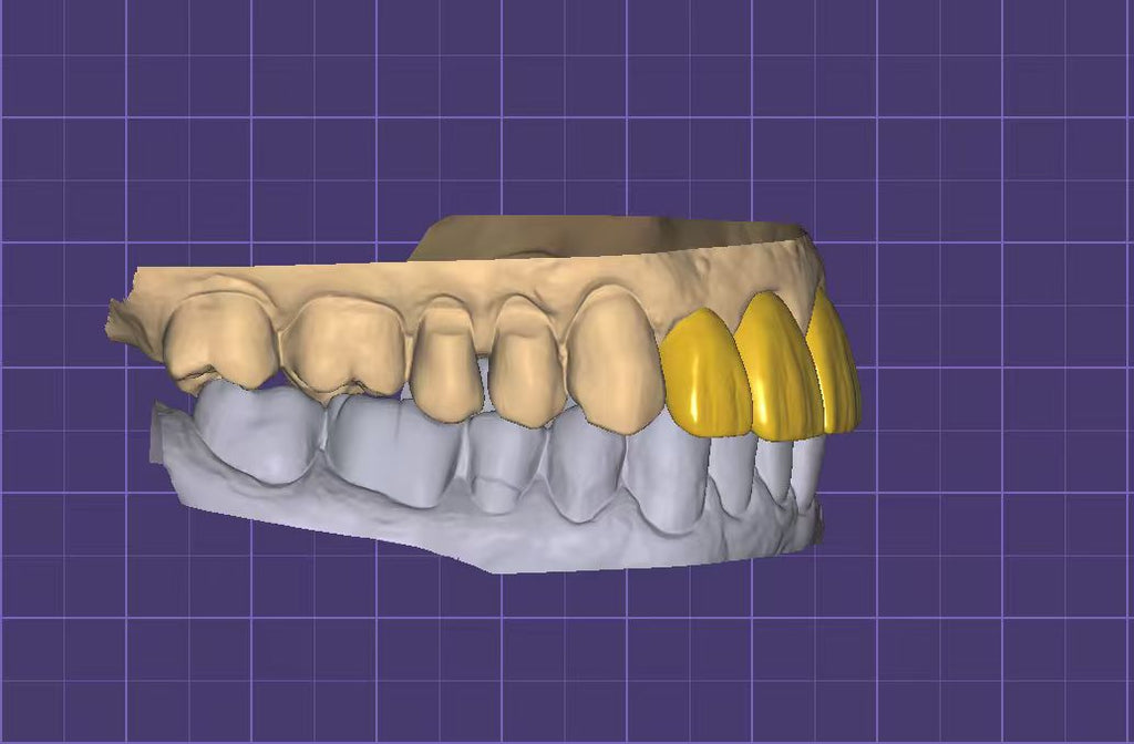 Regular Crown Design